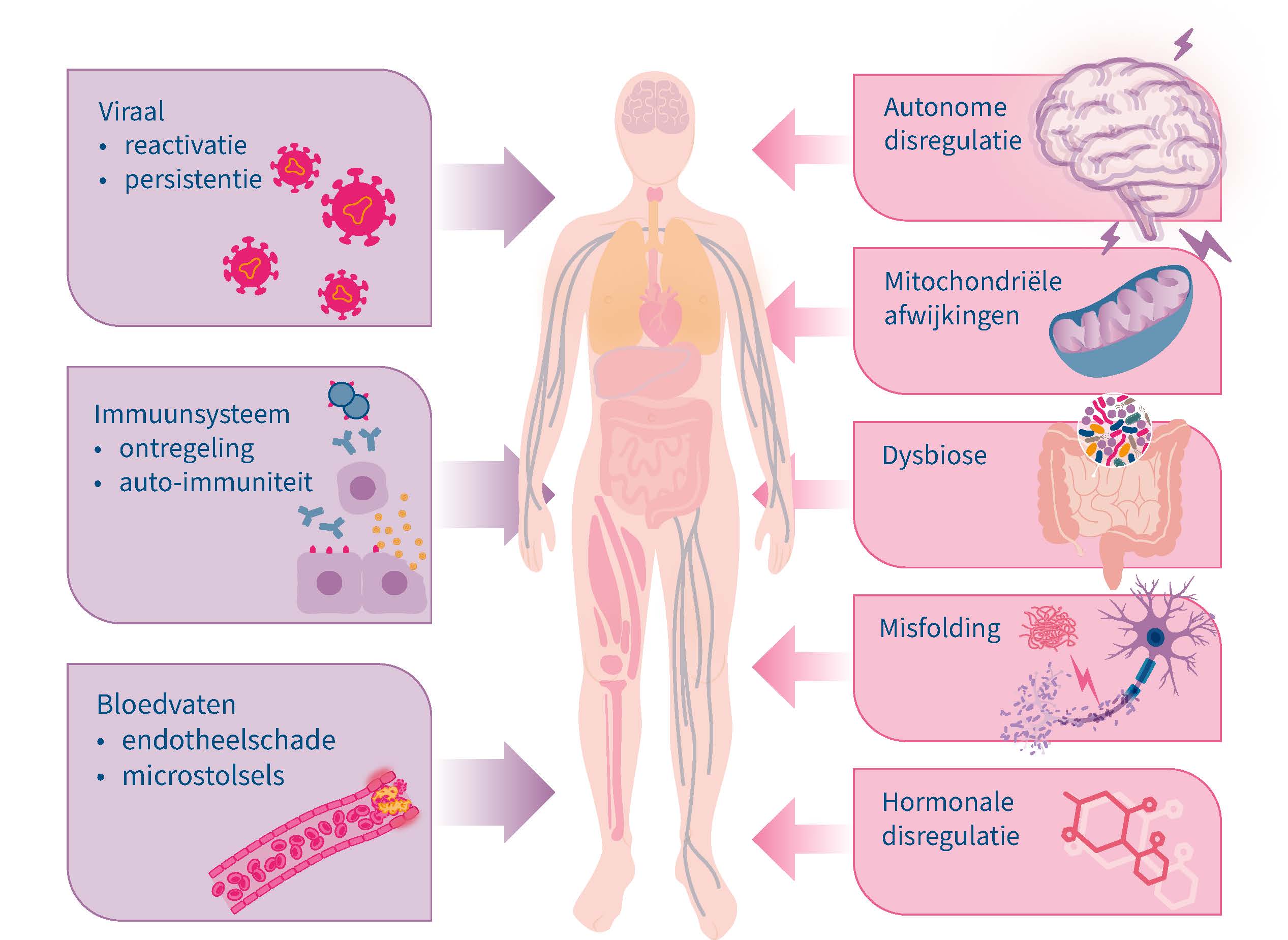 Visuele uitleg van de theorieën over Post Covid Syndroom